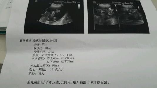 羊水的作用 羊水的3大作用