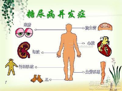 糖尿病要注意什么 糖尿病开车要注意什么