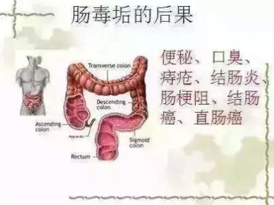 如何清理肠道垃圾 肠道垃圾要如何打扫