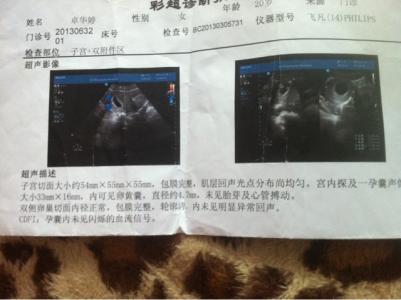 着床晚多久能看到孕囊 怀孕多久能看到孕囊