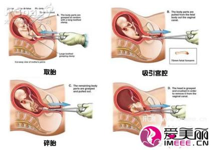 流产后饮食菜谱及做法 流产后饮食要注意什么