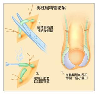 体外排精避孕法 体外排精的避孕方式安全吗