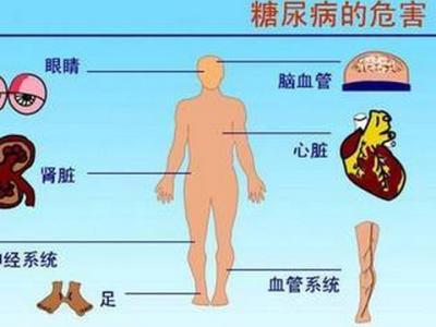 糖尿病并发症 如何远离糖尿病并发症