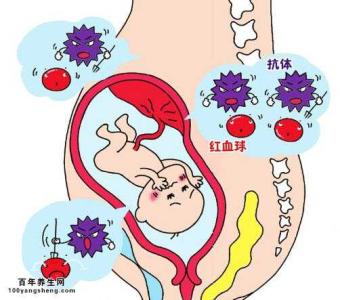 如何预防新生儿溶血 新生儿溶血病的预防和护理