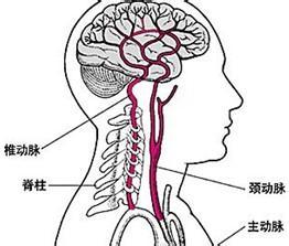 脑供血不足有三大症状 脑供血不足有什么症状