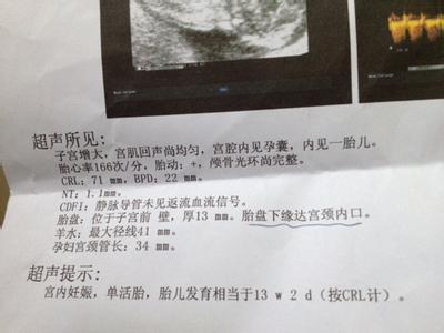 第十八届高交会不足 怀孕不足十八周不宜做B超