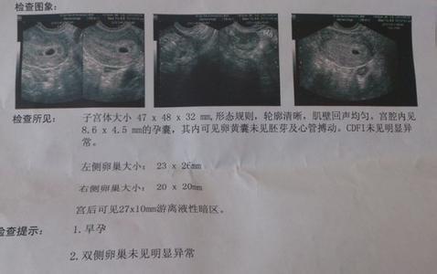 怀孕几天做b超能看见吗 怀孕多久可以做b超看出来