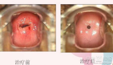 妇科炎症症状图片大全 妇科炎症有什么症状