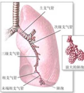 新生儿肺炎的原因 导致新生儿湿肺的原因