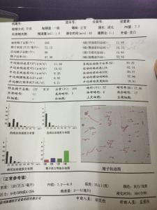 精子质量标准 精子质量相关知识