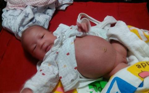新生儿肚子胀气怎么办 怎么知道新生儿的肚子胀不胀