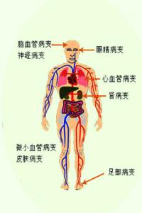 哪些人不适合吃苹果 哪些人不适合吃香蕉