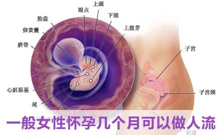 怀孕刚30天能做人流吗 怀孕30天可以做人流吗