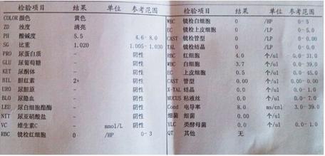 尿蛋白1个加号 做一个单纯的加号