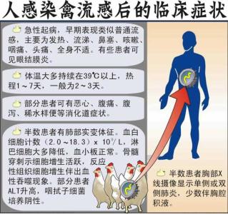 2017禽流感有什么症状 禽流感有什么症状