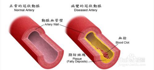 吃什么能清洁血液 吃什么可以净化血液