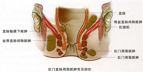 宝宝常见问题 宝宝肛门常见问题大集结