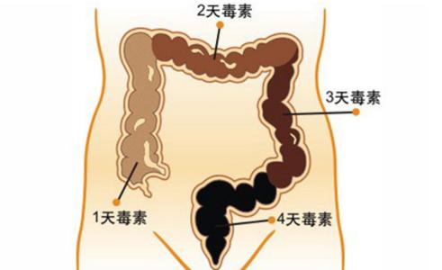 清宿便最有效的方法 清宿便最有效的方法有哪些