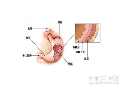 胃痛怎么缓解 胃痛时按哪个部位能缓解