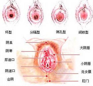 修复处膜的危害 修复处女膜有哪些危害