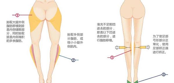 瘦小腿最有效的方法 瘦小腿的简单有效方法