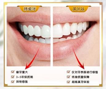 牙齿种类图片大全 牙齿美白种类分析大全