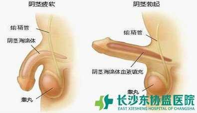 勃起不能的原因 不能勃起什么原因_不能勃起的原因