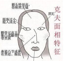 这七处长痣女人克夫 克夫的女人面相