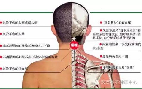 颈椎病并发症有哪些 颈椎病怎么形成的 颈椎病有哪些并发症