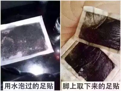 足贴真的可以去湿气吗 足贴变黑真的排毒吗