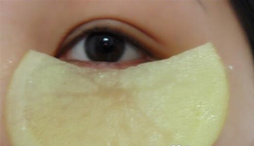 黑眼圈贴土豆片有用吗 土豆片能去黑眼圈吗