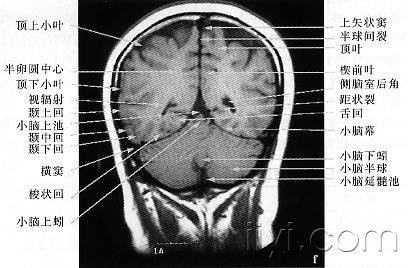 mri工作原理 什么是mri mri的工作原理