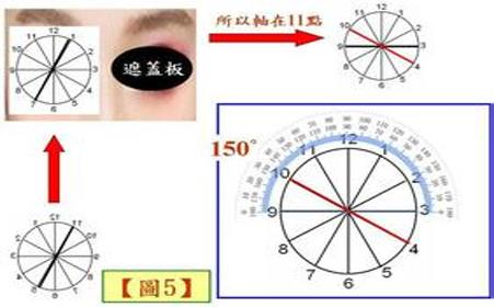 眼睛散光的表现 眼睛散光是怎么形成的 眼睛散光的表现和治疗