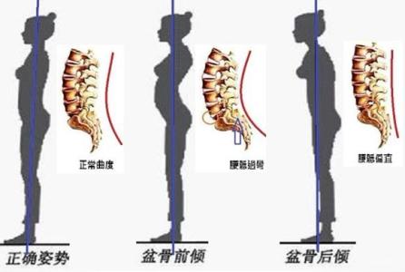 长短腿的形成 长短脚是怎么形成的