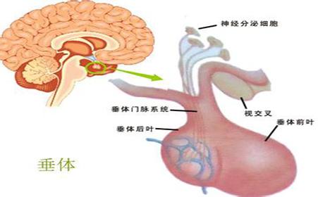 垂体瘤最佳的治疗方法 垂体瘤有哪些治疗 垂体瘤的最佳治疗方法