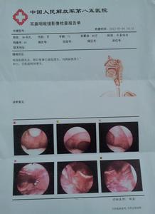 慢性咽喉炎治疗方法 慢性咽喉炎最佳治疗方法吃什么