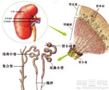 肾小球肾炎的临床表现 什么是肾小球肾炎 肾小球肾炎的表现