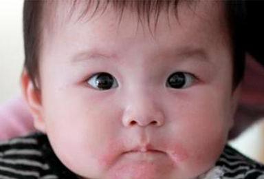 孩子缺铁还是缺钙缺锌，一分钟就能看出来，为孩子收藏！