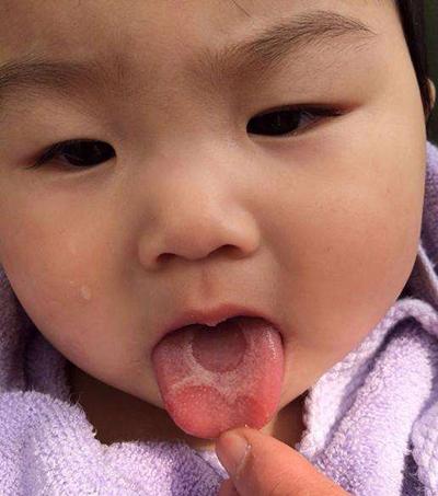 孩子缺铁还是缺钙缺锌，一分钟就能看出来，为孩子收藏！