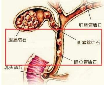 一张“清洁处方”，让你的内脏好好洗个澡