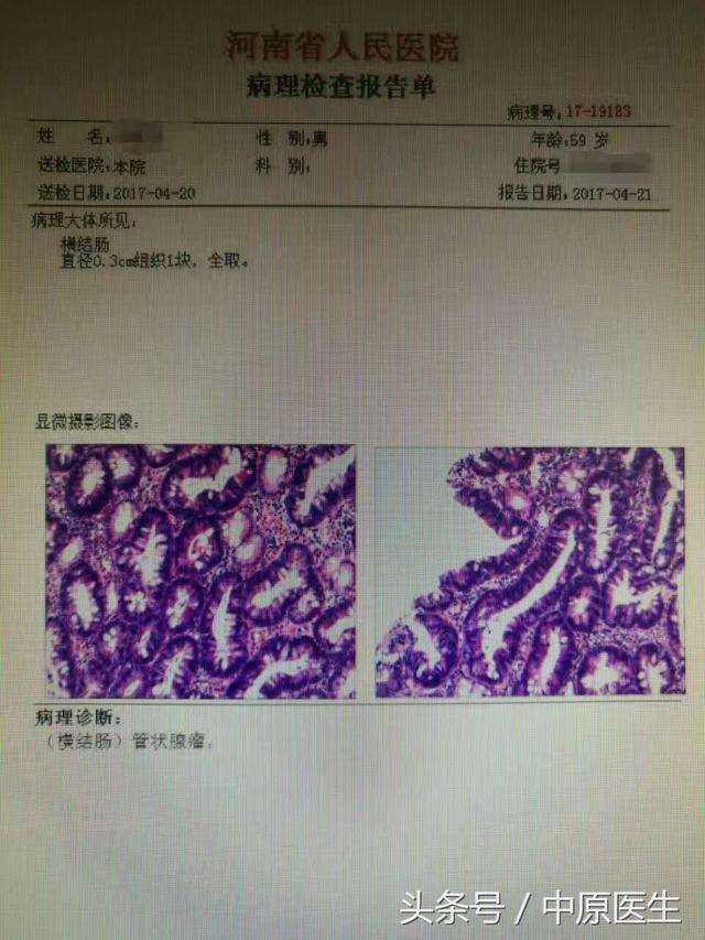 这两个药物可能会引起高烧