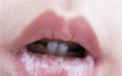 常发生在宝宝身上的5大奇怪状况，你被哪个吓到过？